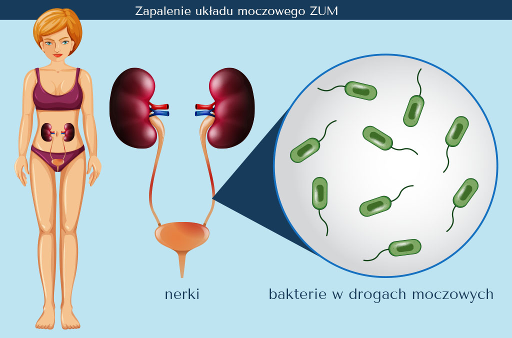 pieluchomajtki dla doroslych tena